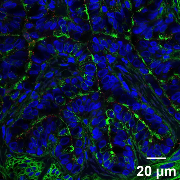 MAL1 H5 Bovine Lung bronchiole